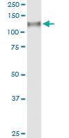 Anti-CDH13 Rabbit Polyclonal Antibody