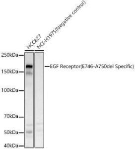 Western blot analysis of various lysates, using Anti-EGFR Antibody (A309525) at 1:400 dilution. The secondary Antibody was Goat Anti-Rabbit IgG H&L Antibody (HRP) at 1:10000 dilution. Lysates/proteins were present at 25 µg per lane