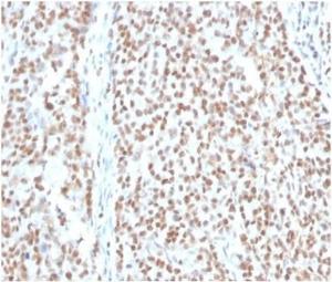 Immunohistochemical analysis of formalin-fixed, paraffin-embedded human colon tissue using Anti-RPA2 Antibody [RPA2/4774]