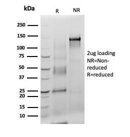 SDS-PAGE analysis of Anti-S100 beta Antibody [S100B/4140] under non-reduced and reduced conditions; showing intact IgG and intact heavy and light chains, respectively. SDS-PAGE analysis confirms the integrity and purity of the antibody