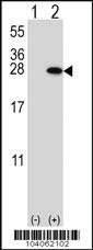 Anti-YWHAB Rabbit Polyclonal Antibody