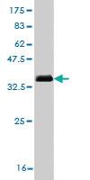 Anti-CRTAP Mouse Monoclonal Antibody [clone: 4D9]