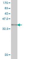 Anti-ZNF281 Mouse Monoclonal Antibody [clone: 4F7]