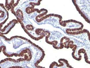 Anti-Cytokeratin 7 antibody