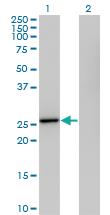 Anti-IL27 Mouse Polyclonal Antibody