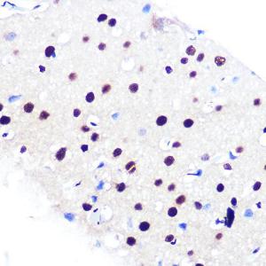 Immunohistochemistry analysis of paraffin-embedded rat brain using Anti-RBBP4 Antibody [ARC0813] (A306852) at a dilution of 1:100 (40x lens). Perform microwave antigen retrieval with 10 mM PBS buffer pH 7.2 before commencing with IHC staining protocol