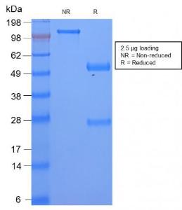 SDS-PAGE analysis of Anti-Serum Amyloid A Antibody [SAA/2868R] under non-reduced and reduced conditions; showing intact IgG and intact heavy and light chains, respectively. SDS-PAGE analysis confirms the integrity and purity of the Antibody