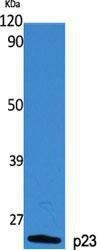 Anti-TEBP antibody