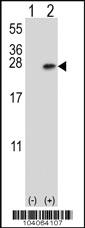 Anti-YWHAB Rabbit Polyclonal Antibody