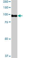 Anti-CDH13 Rabbit Polyclonal Antibody