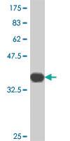 Anti-TNFRSF11A Mouse Polyclonal Antibody