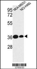 Anti-TAZ Rabbit Polyclonal Antibody (AP (Alkaline Phosphatase))