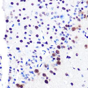 Immunohistochemistry analysis of paraffin-embedded mouse brain using Anti-RBBP4 Antibody [ARC0813] (A306852) at a dilution of 1:100 (40x lens). Perform microwave antigen retrieval with 10 mM PBS buffer pH 7.2 before commencing with IHC staining protocol