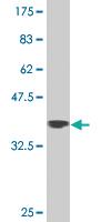 Anti-ZNF281 Mouse Monoclonal Antibody [clone: 1C9]