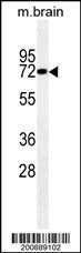 Anti-LIMK1 Mouse Monoclonal Antibody [clone: 175CT3.2.5]