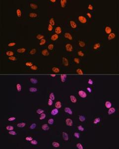 Immunofluorescence analysis of C6 cells using Anti-RBBP4 Antibody [ARC0813] (A306852) at a dilution of 1:100 (40x lens). DAPI was used to stain the cell nuclei (blue)