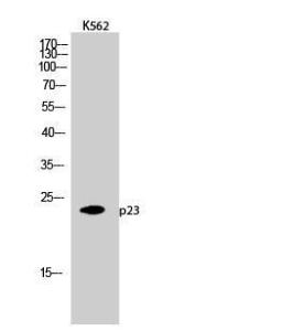 Anti-TEBP antibody