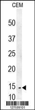 Anti-CRCT1 Rabbit Polyclonal Antibody (APC (Allophycocyanin))