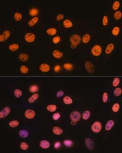 Immunofluorescence analysis of NIH-3T3 cells using Anti-RBBP4 Antibody [ARC0813] (A306852) at a dilution of 1:100 (40x lens). DAPI was used to stain the cell nuclei (blue)