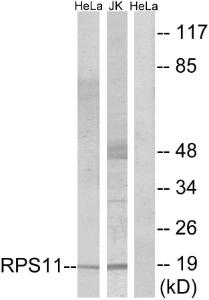 Anti-RPS11 antibody