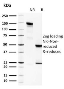 SDS-PAGE analysis of Anti-Spermidine Antibody [CPTC-SAT1-3] under non-reduced and reduced conditions; showing intact IgG and intact heavy and light chains, respectively. SDS-PAGE analysis confirms the integrity and purity of the antibody.