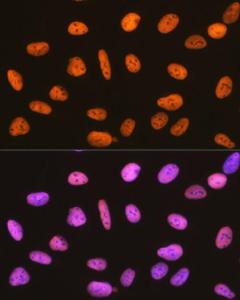 Immunofluorescence analysis of U-2 OS cells using Anti-RBBP4 Antibody [ARC0813] (A306852) at a dilution of 1:100 (40x lens). DAPI was used to stain the cell nuclei (blue)