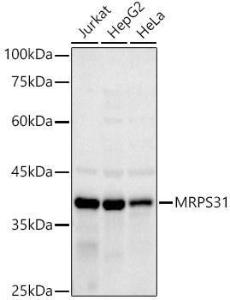 Western blot analysis of extracts of various cell lines, using Anti-MRPS31 Antibody [ARC2914] (A308042) at 1:1,000 dilution. The secondary antibody was Goat Anti-Rabbit IgG H&L Antibody (HRP) at 1:10,000 dilution.