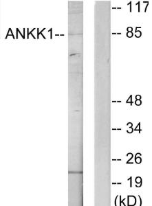 Western blot analysis of lysates from HeLa cells using Anti-ANKK1 Antibody. The right hand lane represents a negative control, where the Antibody is blocked by the immunising peptide