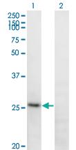 Anti-FGA Mouse Monoclonal Antibody [clone: 1D12]