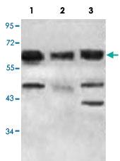 Anti-ACAD9 Rabbit Polyclonal Antibody