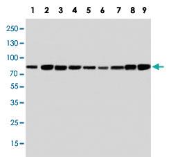 Anti-PIK3R1 Rabbit Polyclonal Antibody