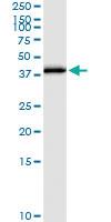 Anti-E2F6 Polyclonal Antibody Pair