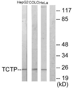 Western blot analysis of lysates from HepG2 and COLO205/HeLa cells using Anti-TCTP Antibody. The right hand lane represents a negative control, where the antibody is blocked by the immunising peptide.