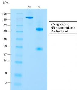 SDS-PAGE analysis of Anti-CD8A Antibody [C8/1779R] under non-reduced and reduced conditions; showing intact IgG and intact heavy and light chains, respectively. SDS-PAGE analysis confirms the integrity and purity of the antibody