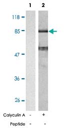 Anti-CTNNB1 Rabbit Polyclonal Antibody