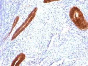 Anti-Cytokeratin 7 antibody