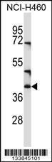 Anti-CD1C Rabbit Polyclonal Antibody (Biotin)