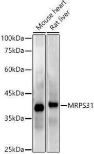 Western blot analysis of extracts of various cell lines, using Anti-MRPS31 Antibody [ARC2914] (A308042) at 1:1,000 dilution. The secondary antibody was Goat Anti-Rabbit IgG H&L Antibody (HRP) at 1:10,000 dilution.