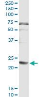 Anti-FGA Mouse Monoclonal Antibody [clone: 1D12]