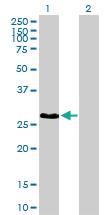 Anti-UBE2Z Mouse Polyclonal Antibody