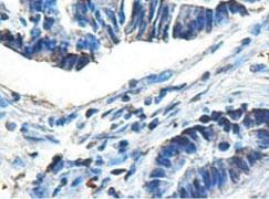 Anti-ACAD9 Rabbit Polyclonal Antibody