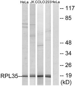 Antibody anti-RPL35 A97273-100 100 µg