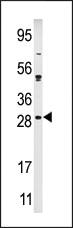 Anti-KIP2 Rabbit Polyclonal Antibody [clone: 366CT28.2.3]