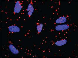 Anti-FGA Mouse Monoclonal Antibody [clone: 1D12]