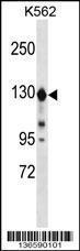 Anti-ESYT1 Rabbit Polyclonal Antibody (AP (Alkaline Phosphatase))