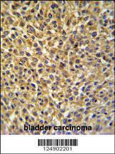 Anti-CRIP1 Rabbit Polyclonal Antibody (FITC (Fluorescein Isothiocyanate))