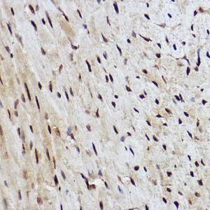 Immunohistochemistry analysis of paraffin-embedded mouse heart using Anti-RanBP3 Antibody [ARC2496] (A306855) at a dilution of 1:100 (40X lens). Perform high pressure antigen retrieval with 10 mM citrate buffer pH 6.0 before commencing with IHC staining protocol