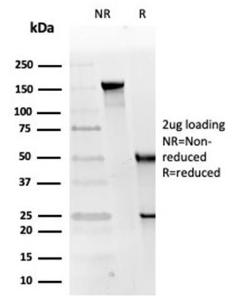 SDS-PAGE analysis of Anti-RPA2 Antibody [RPA2/4774] under non-reduced and reduced conditions; showing intact IgG and intact heavy and light chains, respectively. SDS-PAGE analysis confirms the integrity and purity of the Antibody