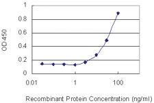 Anti-FGA Mouse Monoclonal Antibody [clone: 1D12]