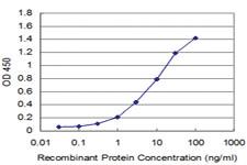 Anti-ZNF496 Mouse Monoclonal Antibody [clone: 4B1]